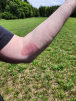 Tribut.JPG (1.35 MiB) 3117 mal betrachtet Dieses Jahr nur Tribut, aber kein Blutzoll, als es einen Pfeil zerrissen hat (man sieht schön die Narbe vom letzten Jahr)