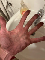 Schön gefärbte Handflächen....das war NACH dem Händewaschen :P